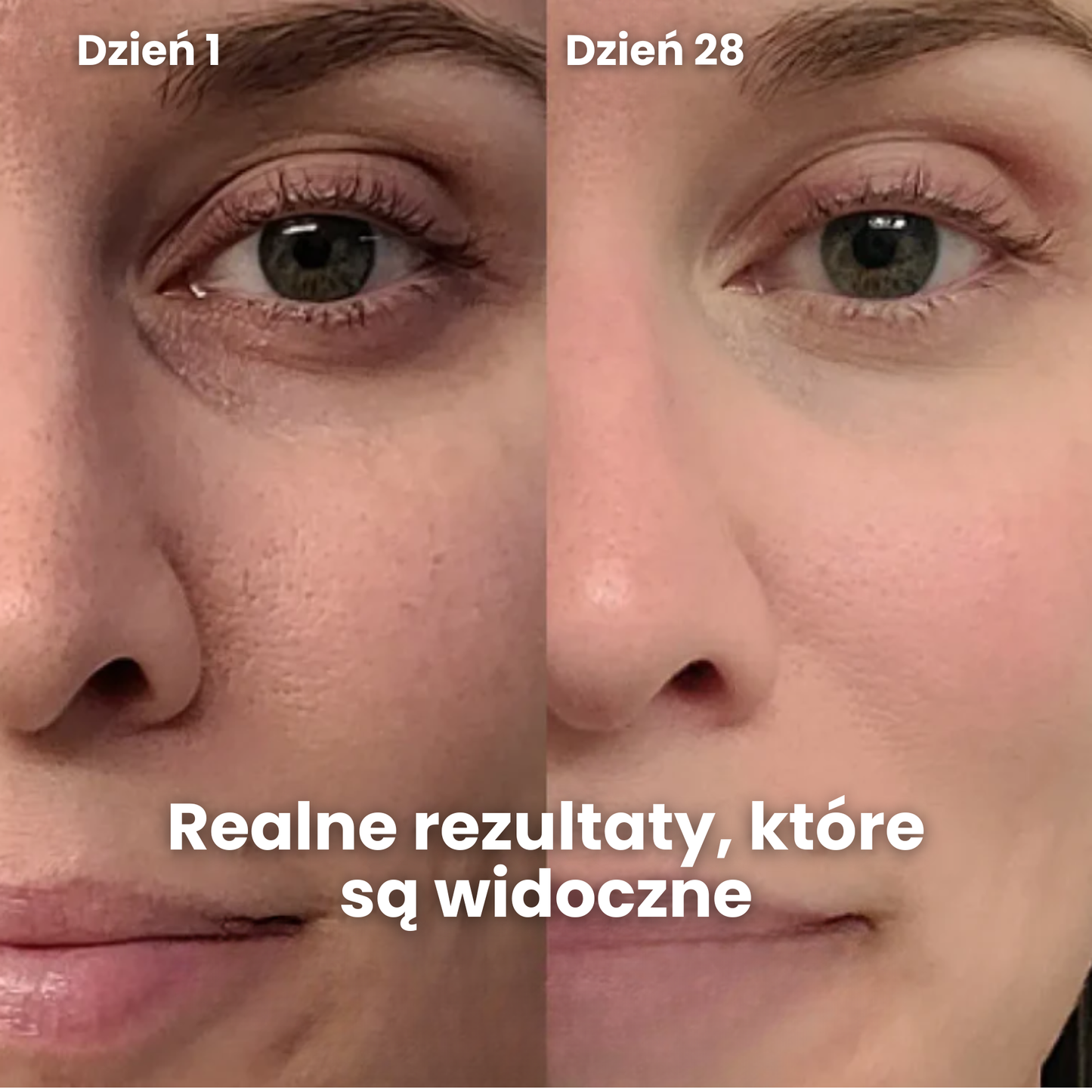 GlowSense – Profesjonalna maska LED do terapii czerwonym światłem