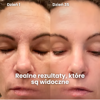 GlowSense – Profesjonalna maska LED do terapii czerwonym światłem